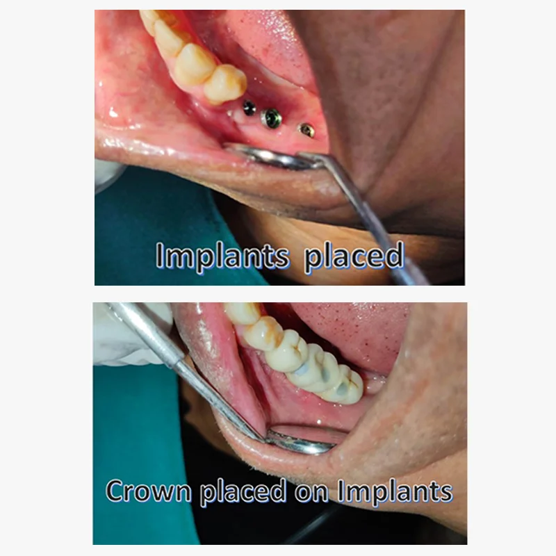 Before and After